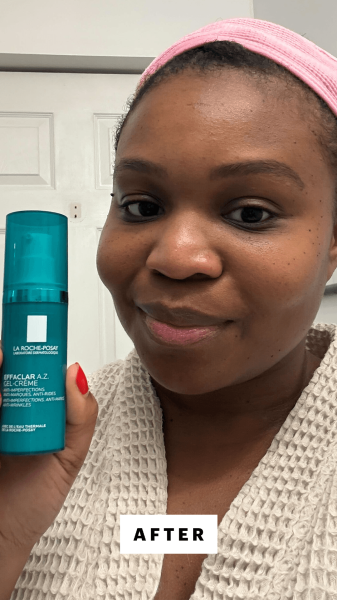 Cruel after applying the La RochePosay Effaclar A.Z. Gel Azelaic Acid Acne Treatment